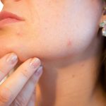 Astuces beauté : comment prendre soin de sa peau grasse au quotidien ?